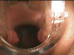 gyno 검 시험